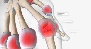 budowa-i-funkcje-kosci-ramiennej-anatomia-i-kluczowe-elementy