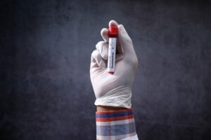 niskie-neutrofile-i-podwyzszone-limfocyty---co-oznaczaja-te-wyniki