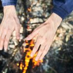 rodzaje-i-stopnie-oparzen-charakterystyka-oraz-zagrozenia-dla-zycia